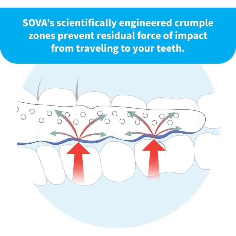 Dental night guard designed for teeth grinding protection, shown with molded guard and storage case.