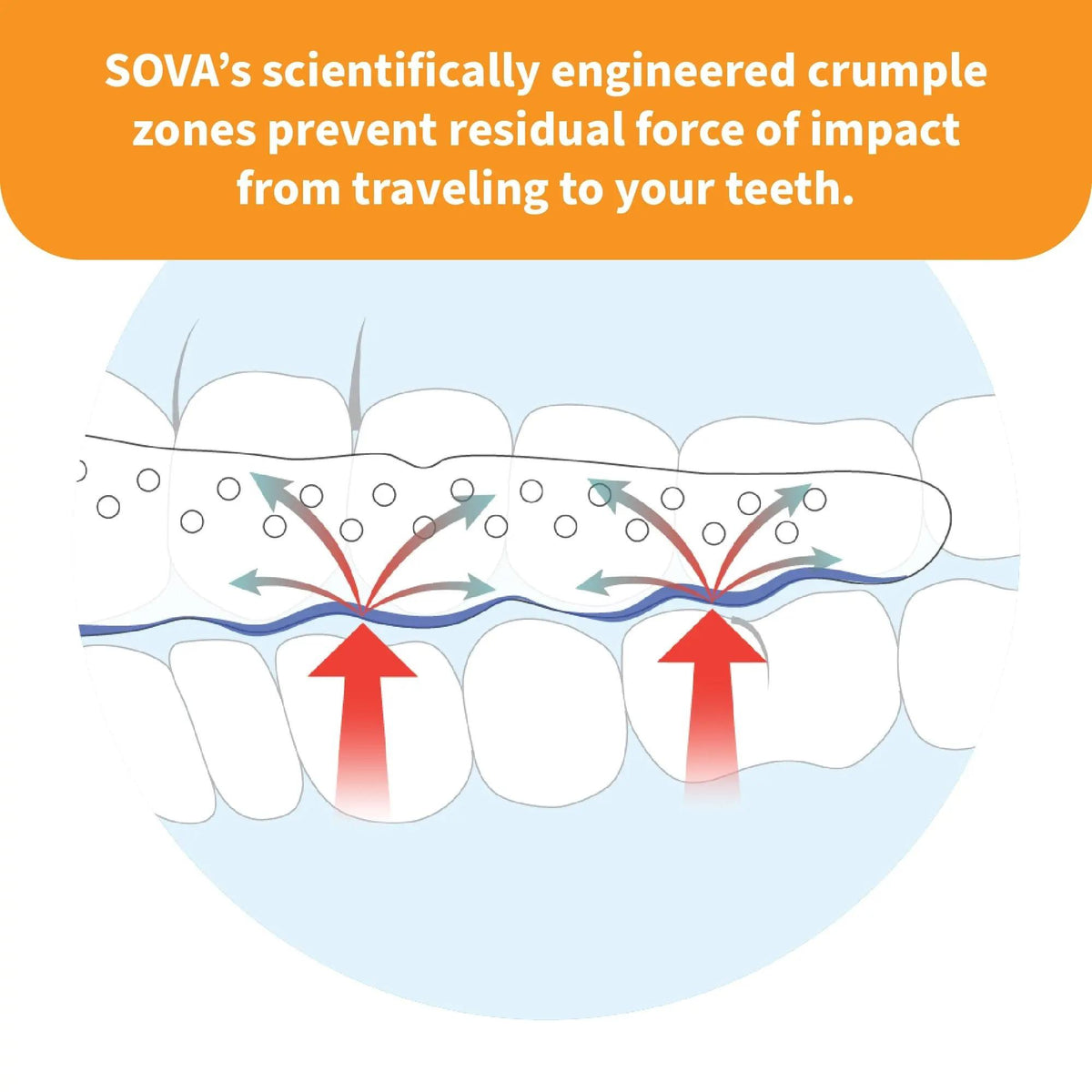 Junior dental night guard designed for protecting teeth during sleep.