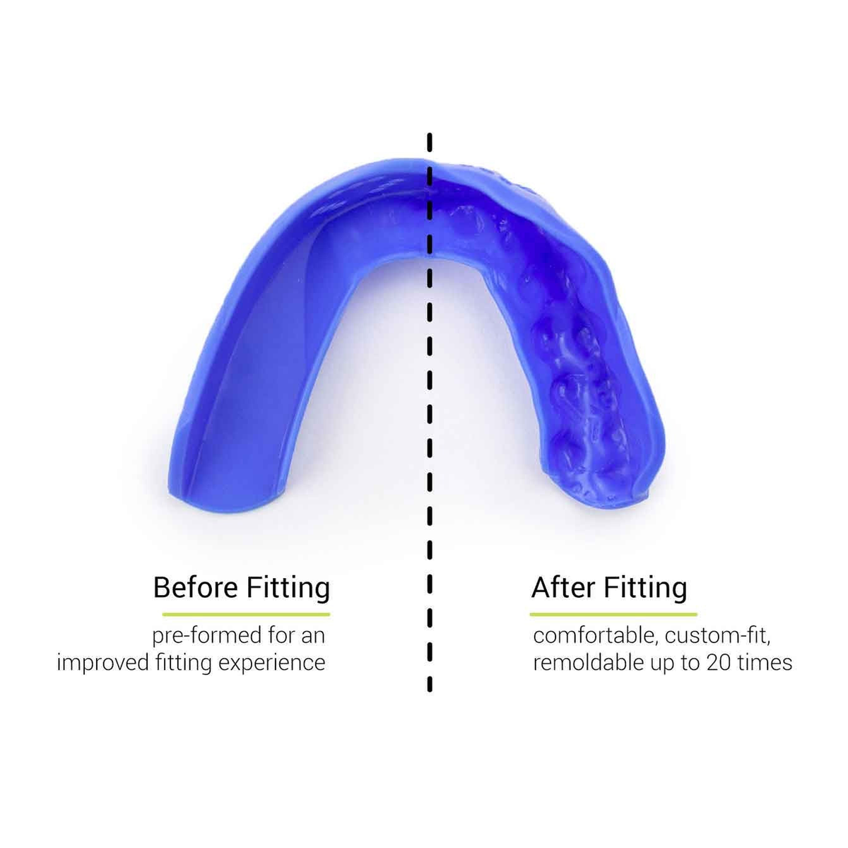 SISU 3D Custom Fit Mouthguard